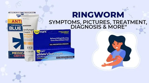 Ringworm: Symptoms, Pictures, Treatment, Diagnosis & More HerbsPro